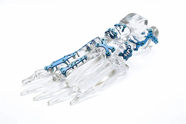 Medical titanium plates